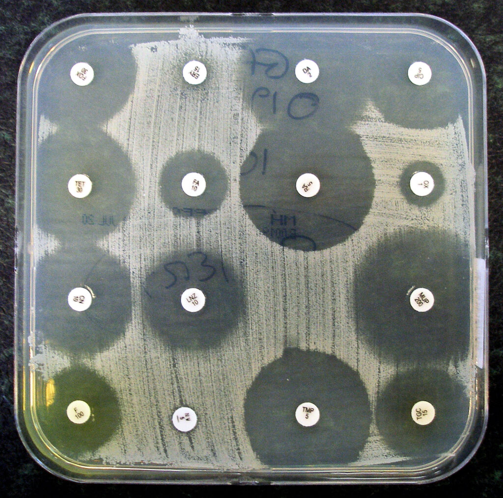 A petri dish coated with bacteria and dotted with antibiotic paper discs, showing clear zones of inhibition where the drugs killed the bacteria