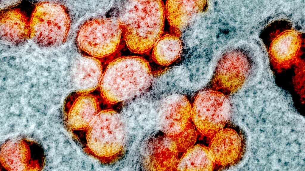 Color-enhanced transmission electron micrograph of SARS-CoV-2 virus particles