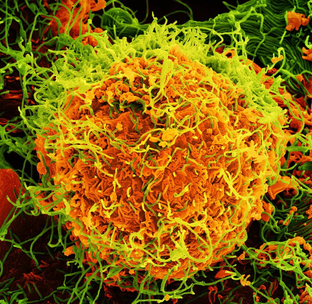 Colorized scanning electron microscope image of Ebola virus particles budding from the surface of an infected cell