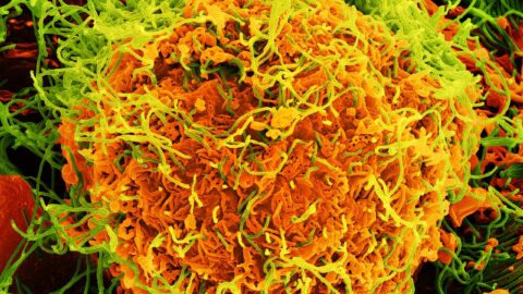 Colorized scanning electron microscope image of Ebola virus particles budding from the surface of an infected cell