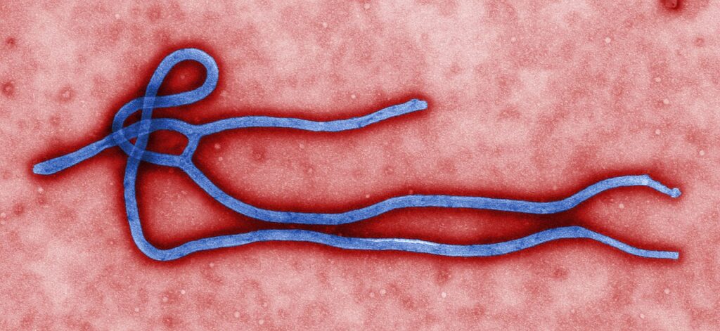 Colorized electron micrograph of an Ebola virus virion under magnification