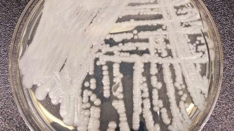 A strain of Candida auris growing in a petri dish at a CDC laboratory
