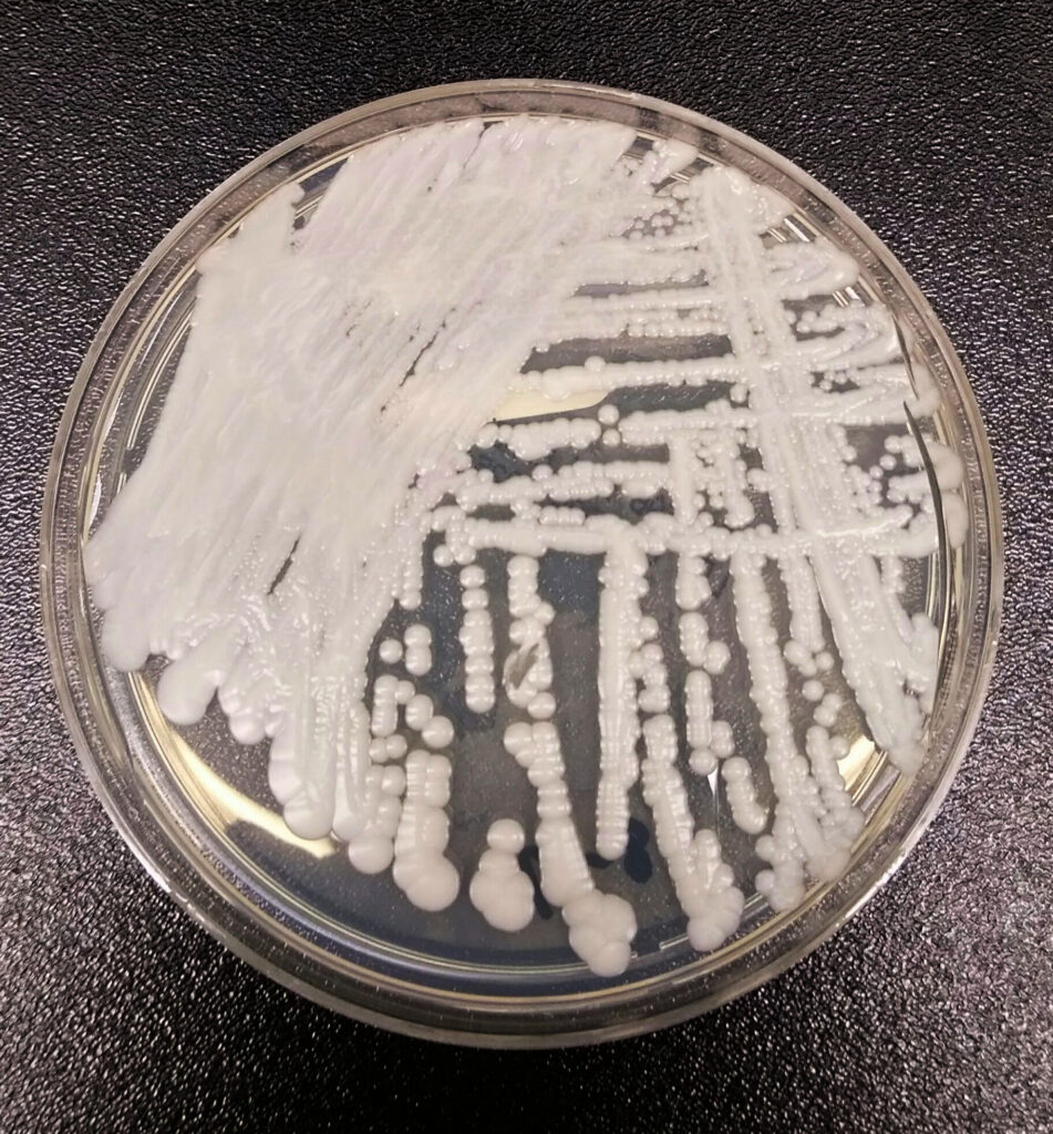 A strain of Candida auris growing in a petri dish at a CDC laboratory